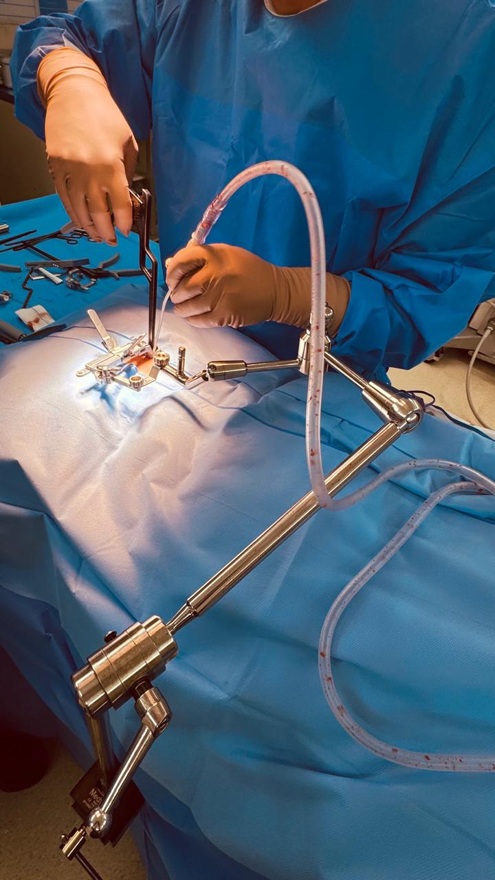 Trabajo neuroquirúrgico con magnificación y campo estéril